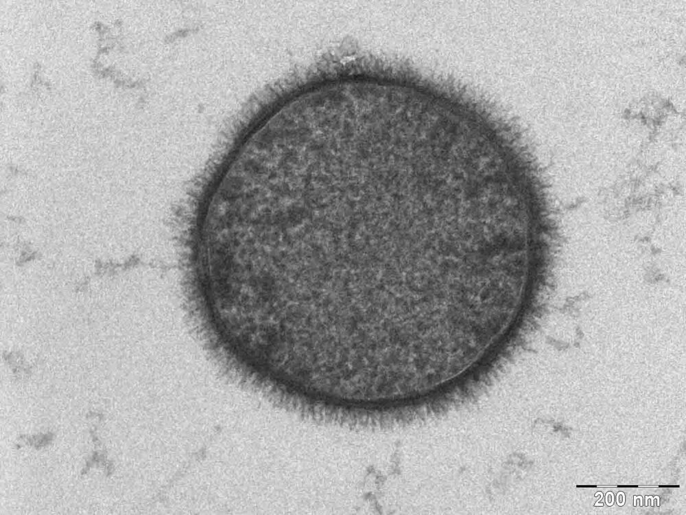 Клетка Bacillus subtilis под электронным микроскопом (срез)